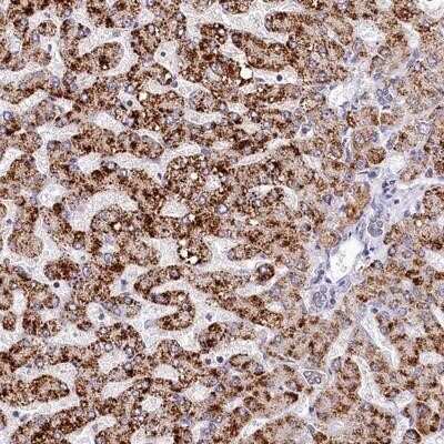Immunohistochemistry-Paraffin: SPINK9 Antibody [NBP1-90990]