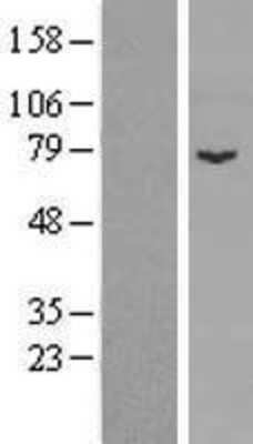 Western Blot: SPIRE1 Overexpression Lysate [NBP2-06666]