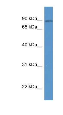 Western Blot: SPIRE2 Antibody [NBP1-79813]