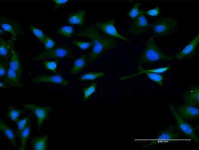 Immunocytochemistry/ Immunofluorescence: SPO11 Antibody [H00023626-D01P]