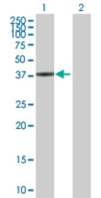 Western Blot: SPO11 Antibody [H00023626-B01P]