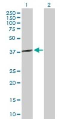 Western Blot: SPO11 Antibody [H00023626-D01P]