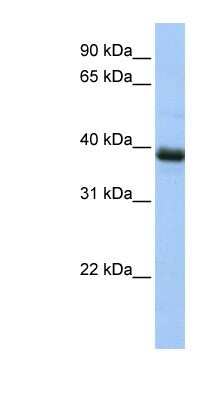 Western Blot: SPO11 Antibody [NBP1-58172]