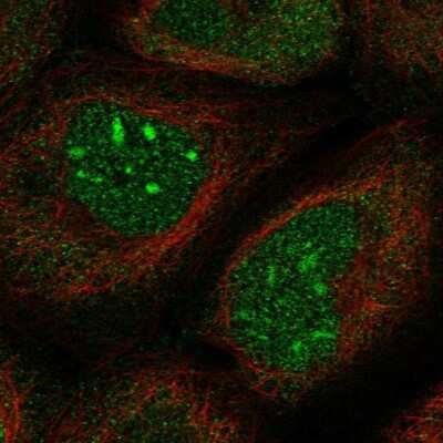 Immunocytochemistry/ Immunofluorescence: SPOCD1 Antibody [NBP1-93922]