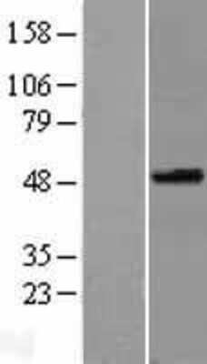 Western Blot: Testican 3/SPOCK3 Overexpression Lysate [NBL1-16416]