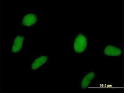 Immunocytochemistry/ Immunofluorescence: SPOP Antibody [H00008405-B01P]