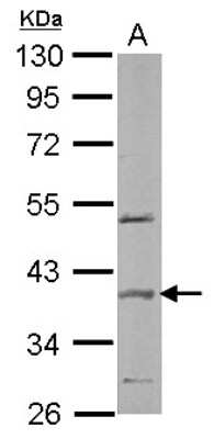 Western Blot: SPOP Antibody [NBP1-33090]