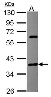 Western Blot: SPOP Antibody [NBP2-20477]