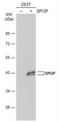 Western Blot: SPOP Antibody [NBP2-20477]