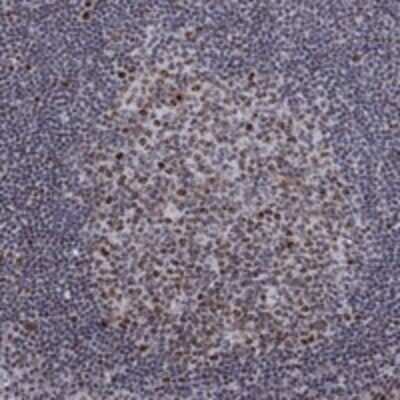 Immunohistochemistry-Paraffin: SPOUT1 Antibody [NBP3-17625]
