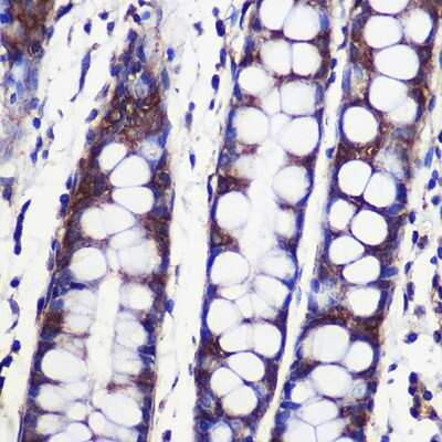 Immunohistochemistry-Paraffin: SPPL2a Antibody - Azide and BSA Free [NBP2-93234]