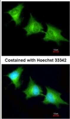 Immunocytochemistry/ Immunofluorescence: SPR Antibody [NBP1-33546]