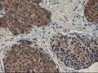 Immunohistochemistry: SPR Antibody (OTI4F5) - Azide and BSA Free [NBP2-74344]