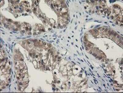 Immunohistochemistry: SPR Antibody (OTI4F5) - Azide and BSA Free [NBP2-74344]