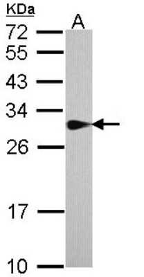 Western Blot: SPR Antibody [NBP1-33546]
