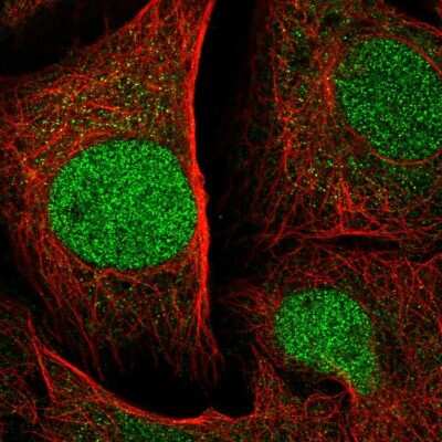 Immunocytochemistry/ Immunofluorescence: SPRED1 Antibody [NBP2-57368]