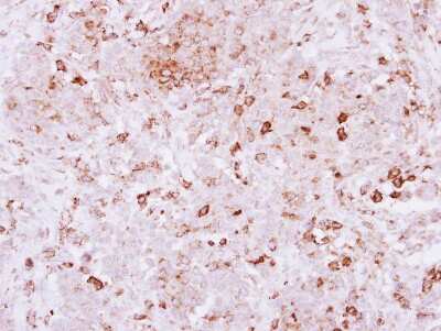 Immunohistochemistry-Paraffin: SPRED2 Antibody [NBP2-20478]