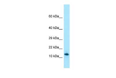 Western Blot: SPRN Antibody [NBP3-09442]