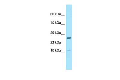 Western Blot: SPRN Antibody [NBP3-09443]