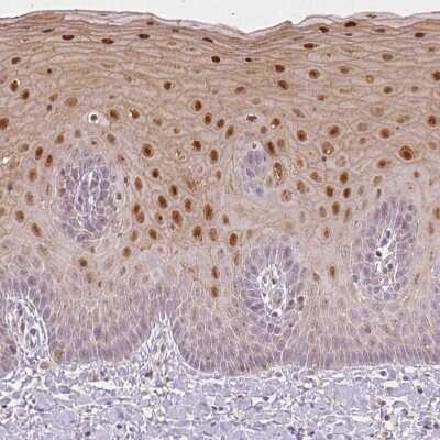 Immunohistochemistry-Paraffin: SPRR3 Antibody [NBP2-13374]