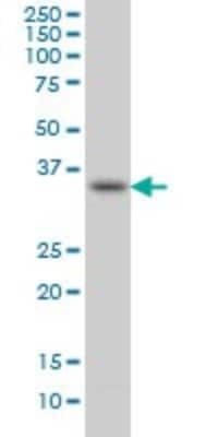 Western Blot: SPRY1 Antibody (3H4) [H00010252-M01]