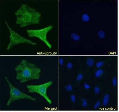 Immunocytochemistry/ Immunofluorescence: SPRY1 Antibody [NBP1-51918]