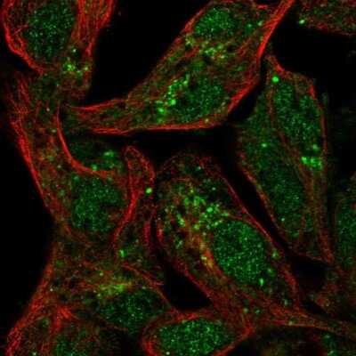 Immunocytochemistry/ Immunofluorescence: SPRY1 Antibody [NBP2-57267]