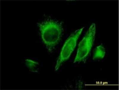 Immunocytochemistry/ Immunofluorescence: SPRY2 Antibody (1E10) [H00010253-M01]