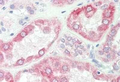Immunohistochemistry: SPRY2 Antibody [NBP2-13158]