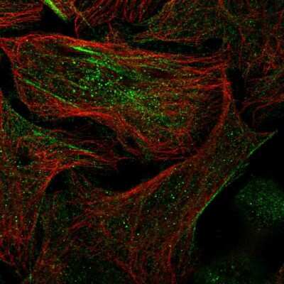 Immunocytochemistry/ Immunofluorescence: SPRYD3 Antibody [NBP1-83681]