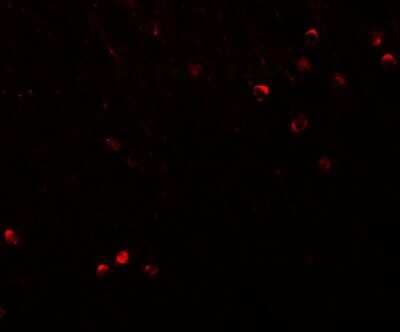 Immunohistochemistry: SPRYD3 Antibody - BSA Free [NBP1-77116]