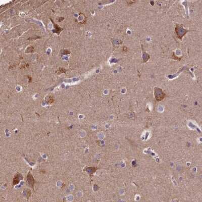 Immunohistochemistry-Paraffin: SPRYD3 Antibody [NBP2-38451]