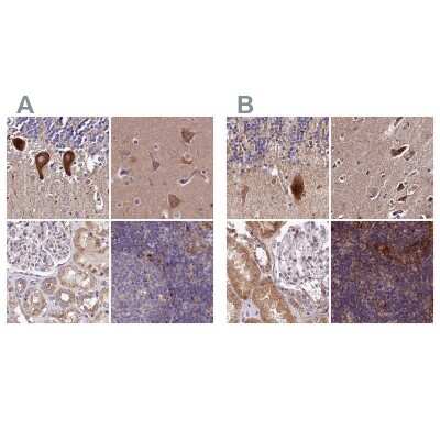 Immunohistochemistry-Paraffin: SPRYD3 Antibody [NBP2-38451]