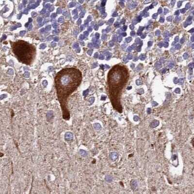 Immunohistochemistry-Paraffin: SPRYD3 Antibody [NBP2-38451]