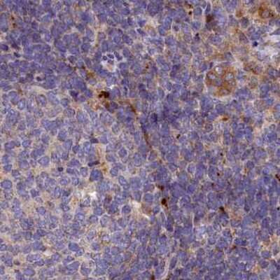 Immunohistochemistry-Paraffin: SPRYD3 Antibody [NBP2-38451]