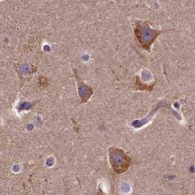 Immunohistochemistry-Paraffin: SPRYD3 Antibody [NBP2-38451]