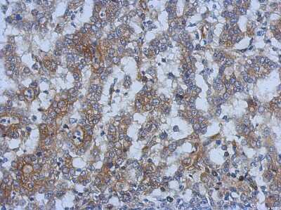 Immunohistochemistry-Paraffin: SPRYD5 Antibody [NBP2-15126]