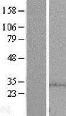 Western Blot: SPSB1 Overexpression Lysate [NBL1-16438]