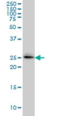 Western Blot: SPSB2 Antibody (1E6) [H00084727-M01]