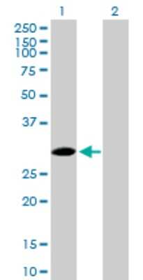 Western Blot: SPSB2 Antibody [H00084727-B01P]