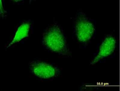 Immunocytochemistry/ Immunofluorescence: SPSB3 Antibody [H00090864-B01P]