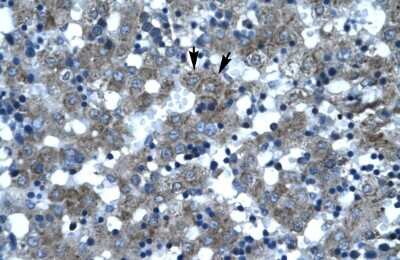 Immunohistochemistry-Paraffin: SPT3 Antibody [NBP2-85816]