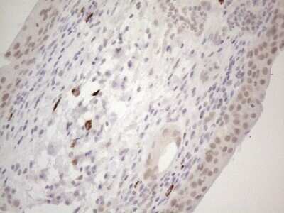 Immunohistochemistry: SPT3 Antibody (OTI1A5) - Azide and BSA Free [NBP2-74348]