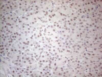Immunohistochemistry: SPT3 Antibody (OTI1A5) [NBP2-45466]