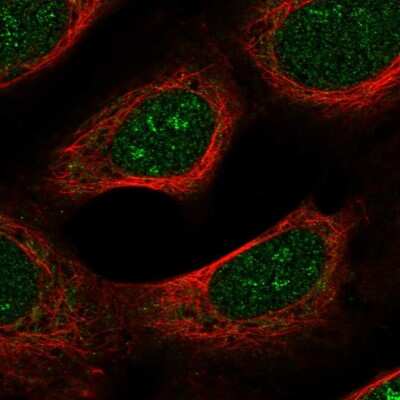 Immunocytochemistry/ Immunofluorescence: SPTBN4 Antibody [NBP2-49131]