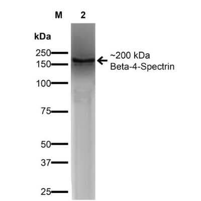 Western Blot: SPTBN4 Antibody (S393-2) [NBP2-59321]