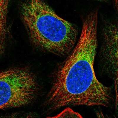 Immunocytochemistry/ Immunofluorescence: SPTLC1 Antibody [NBP2-56477]