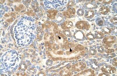 Immunohistochemistry-Paraffin: SPTLC1 Antibody [NBP1-59643]
