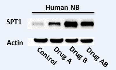Western Blot: SPTLC1 Antibody [NBP1-59643]