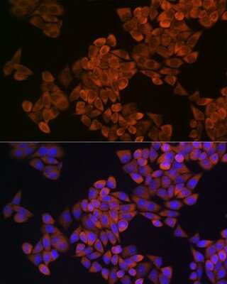 Immunocytochemistry/ Immunofluorescence: SQLE Antibody - Azide and BSA Free [NBP2-93808]